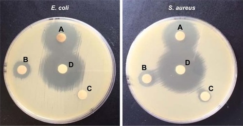 Figure 7 Antibacterial activity of Fe3O4@PEG–Ag nanostructures against human pathogens: (A) Fe3O4@PEG–Ag, (B) Fe3O4 NPs, (C) Fe3O4@PEG and (D) positive control (tetracycline).Abbreviations: PEG, poly(ethylene glycol); NP, nanoparticle; E. coli, Escherichia coli; S. aureus, Staphylococcus aureus.