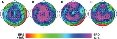 Figure 4 Topographic maps of ERD/ERS% of the high-frequency alpha rhythm band in the congruence (A), incongruence (B), intention (C), and proprioception (D) conditions.