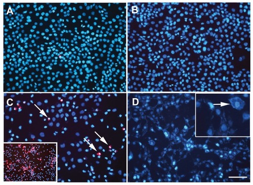 Figure 5 1321N1 cells stained to detect apoptosis using Hoechst (blue) and antiactivated caspase-3 antibody (red). (A) Control cells. (B) Cells irradiated with laser at 1.2 W for 20 minutes. (C) Cells incubated with 36 μg/mL gold nanorods for 20 minutes. (D) Cells irradiated with laser for 20 minutes in the presence of 36 μg/mL gold nanorods.Notes: Only a few activated caspase-3-positive cells were detected when incubated with gold nanorods, indicated by arrows in (C). Positive cells were present in a very low number compared with the apoptotic cells obtained when cells were treated with staurosporine, in which a high number of caspase-3-positive cells were observed, shown in the inset in (C). No chromatin condensation visualized by Hoechst or activated caspase-3-positive cells were seen in the other conditions tested (A, B, and D).Note: Scale bar, 50 μm.