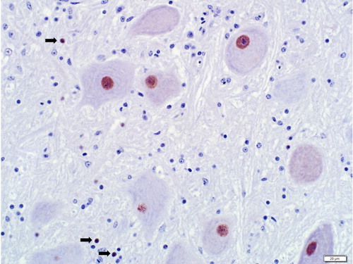 Figure 2. Positive immunohistochemical staining for ABV in neuronal and glial cell (arrows) nuclei in the brain of an emu (D. novaehollandiae) positive for aquatic bird bornavirus-1. Rabbit polyclonal antisera for parrot bornavirus-2 nucleocapsid protein.