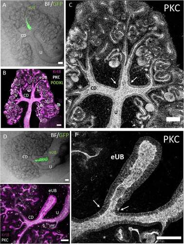 Figure 5. Connections between grafted eUBs and host CD/Ureter show open lumens. (a) Bright field image showing the GFP-eUB connected to the collecting duct system of a host kidney and showing branching. (b) The apical domain protein kinase C (PKC), and the epithelial marker Krt8 stain of the grafted kidney showing a connected lumen between the eUB graft and the collecting duct branches of the host kidney (arrow), early nephrons (expressing PODXL) can be seen connected to the graft. (c) Isolated channel of PKC, for clarity. (d) Bright field image of an GFP-eUB connected to the ureter of a cultured kidney, to show the position of the graft (e) The apical domain PKC and the epithelial marker Krt8 stain showing that the lumen is continuous between the graft and host tubules (arrows). (f) Shows the PKC channel only for clarity. (U: ureter, CD: collecting duct, eUB: engineered UB). Scale bar = 100 µm.