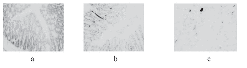 Figure 2. Staining results of colon transverse section of three groups of mice (a): IBS model group; (b): sodium butyrate group; (c): blank control group)