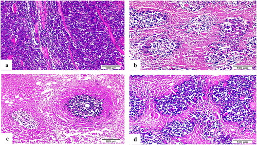 Figure 13. H&E-stained sections of Ehrlich solid tumour tissue (×200). (a) Untreated control demonstrated extensive tumour cell infiltration between individual muscle fibres. (b) Doxorubicin exposed small clusters of cancerous cells. (c) 8b showed minimal infiltration of neoplastic cells and a significant reduction in their quantity. (d) 3b displayed aggregates of neoplastic cells with their typical structure that surrounded by small patches of necrotic muscle tissue.