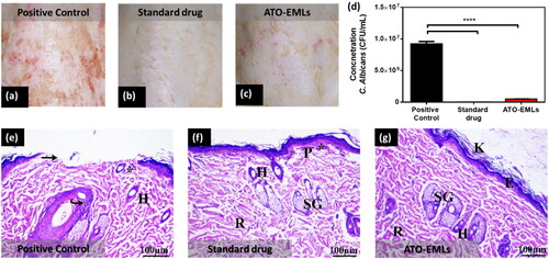 Figure 10. In vivo microbiological study: photographic images of the infected skin area of rat dorsal (a) positive control group, (b) standard drug group, and (c) emulsomes ATO-EMLs group. (d) C. albicans concentration in CFU/mL of different groups (****p < .0001). Histopathological evaluation: (e) Positive group: Perifollicular and intrafollicular infiltration of neutrophils, lymphocytes, and mononuclear cellular infiltration in the dermis (*). Hair follicles (H) with an absence of associated sebaceous glands are observed. Focal areas of epidermal discontinuation (arrow) due to loss of superficial epidermal cell layers (erosion). Increased cellular proliferation (hyperplasia) of some hair follicles as a follicular bulge (curved arrow). (f) Standard drug group: perifollicular and intrafollicular infiltration of neutrophils, lymphocytes, and mononuclear cellular infiltration in the dermis (*). (g) ATO-EMLs group: hyperkeratosis (K) increased the thickness of the stratum corneum with non-nucleated corneocytes, due to alteration in epidermal cell turnover and differentiation of superficial keratinocytes. Normal epidermis thickness (E) was observed. The dermis shows an inner reticular layer (R), hair follicles (H), and Sebaceous glands (SG).