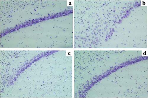Figure 3. Nissl staining results of neurons in the hippocampal CA1 region. (a) C group; (b) SD group; (c) SD + DEX group; and (d) DEX group