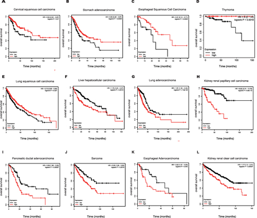 Figure 3 Prognostic value of NUSAP1 in the overall survival of Human Cancers. (A–L) Kaplan-Meier curves of overall survival (OS) according to NUSAP1 expression in various tumors, log rank P<0.05 was considered statistically significant.
