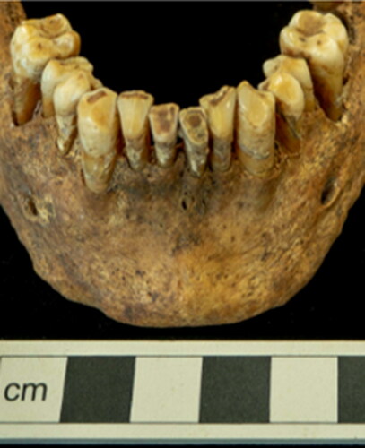 Fig. 9 Wear on the anterior dentition.