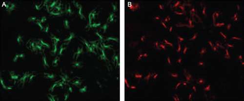 Figure 1. The purity identification of rat primary cultured VSMCs. Isolated VSMCs were fixed and subjected to immunofluorescence with antibodies to α-SMA. (A) The cells were observed under an optical microscope; (B) cells were observed under a fluorescence microscope, and the red fluorescence represented the positive antigen of α-SMA.