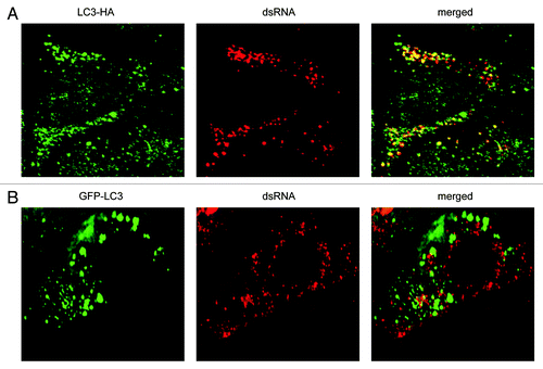 Figure 4. EAV-induced DMVs are associated with LC3-I but not with N-terminally GFP-tagged LC3. Vero E6 cells were transfected with plasmids expressing either C-terminally HA-tagged nonlipidated LC3-I (LC3-HA) (A) or N-terminally GFP-tagged LC3 (GFP-LC3) (B), and subsequently infected with EAV for 16 h before being processed for immunofluorescence analysis.