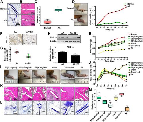 Figure 1 Estradiol reduces cartilage damage and protects articular cartilage in ovariectomized AA rats in vivo. (A) Normal and AA rat right hind ankle joint sections stained with toluidine blue staining. (B) Normal and AA rat right hind ankle joint sections stained with HE staining. (C) The scores of cartilage damage (n = 7), Semiquantitative analysis of ASIC1a protein expression in ankle joint of the E2 group and the AA group (n = 7) were calculated using the IPP 6.0 software. (D) Representative image of paw edema in rats and the joint swelling of the AA group and the normal group were measured by the joint swelling instrument (n = 7). (E) The body weight of all groups (n = 7). (F) Immunohistochemical of ASIC1a in ankle joint of the AA group and the E2 group (n = 7). (G) Semiquantitative analysis of ASIC1a protein expression in ankle joint of the E2 group and the AA group (n = 7) were calculated using the IPP 6.0 software (H) Western blot analysis of ASIC1a expressed in ankle joint of the E2 group and the AA group (n = 7). β-actin served as a loading normal, and the indicated proteins were quantified with Image J software. (I) Representative image of paw edema in rats with adjuvant-induced arthritis (n = 7). (J) The joint swelling of all groups was measured by the joint swelling instrument (n = 7). (K) HE staining in ankle joint of all groups (n = 7). (L) Toluidine blue staining in ankle joint of all groups (n = 7). (M) The scores of cartilage damage. Data are presented as the mean ± SEM of three independent experiments, (C) ***P < 0.001 compared with the Normal group. (G and H) **P < 0.01, ***P < 0.001 versus the AA group. (M) ***P < 0.001 compared with the solvent-treated group.