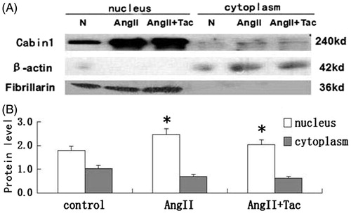 Figure 5. AngII-induced Cabin1 nuclear protein increased in cultured podocytes. Notes: (A) Western blot showed AngII-induced Cabin1 nuclear protein expression significantly increased at 48 h; (B) Quantification of Cabin1 nuclear and cytoplasmic protein expression. *p < 0.05 versus normal control group. N: normal control.
