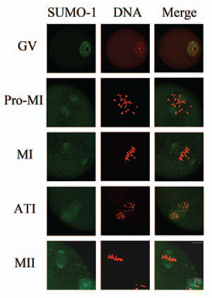 Figure 1 Subcellular localization of SUMO-1 during mouse oocyte maturation. Oocytes were fixed at 0 h, 4 h, 8 h, 9.5 h and 12 h of culture and then stained with a mouse monoclonal antibody specific for SUMO-1 and counterstained with the fluorescent dye propidium Iodide (PI) to visualize DNA. Green, SUMO-1; red, DNA; GV, oocytes at germinal vesicle stage; Pro-MI, oocytes at first prometaphase; MI, oocytes at first metaphase; ATI, oocytes at first anaphase; MII, oocytes at second metaphase. PB, first polar body; Bar = 20 µm. Experiments were repeated at least three times and representative images are shown.