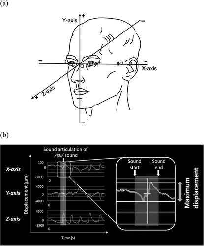 Figure 4. Reference planes in the 3D coordinate system and waveforms representing the motion of each landmark.