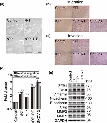 Figure 3. Migration and invasion of the resistant variants and their parental cells. a, Morphology of the resistant variants and parental Capan-1 cells. Scale bar: 100 μm. b and c, Representative images show the migrating (b) and invading (c) cells. Cells were seeded in chambers (migration) or matrigel-coated chambers (invasion), incubated for 24 h (migration) or 48 h (invasion) and then stained with crystal violet. -Magnification: 10 × . d, Quantification results of b and c. The results indicated the combined data from three independent assays. Relative migration or invasion was calculated in relation to parental Capan-1 cells. SKOV-3 cells served as the positive control. All data are presented as the mean ± SD from three independent experiments. * p < .05, ** p < .01, *** p < .001. e, Western blot analysis of the indicated EMT-related proteins in the resistant variants and Capan-1 cells.