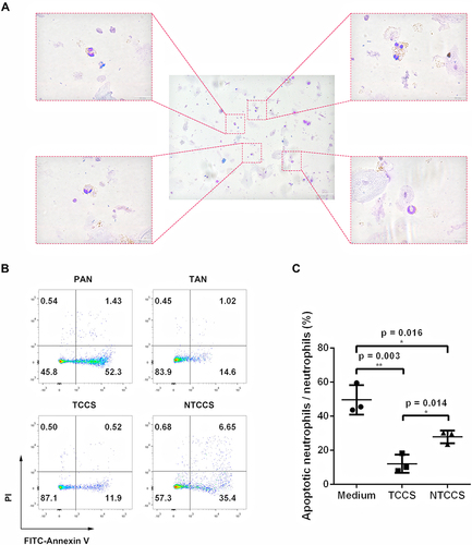 Figure 3 LSCC tumor microenvironment contributes to neutrophil survival. (A) Giemsa staining of the TANs in LSCC showing that these neutrophils were morphologically heterogeneous consisting immature neutrophils with banded nuclei as well as mature segmented neutrophils. (B) Representative dot plots demonstrated the apoptosis of PANs, TANs, and PANs exposed to TTCS or NTTCS from LSCC patients by Annexin V at 16 hours. (C) Statistics analysis of apoptotic neutrophils/neutrophils exposed to TTCS and NTTCS from LSCC patients for 16 hours. *p < 0.05, **p < 0.01.