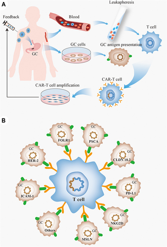 Figure 3 The CAR-T cell therapy and gastric cancer. (A) CAR-T cell treatment procedure for gastric cancer. Patients were assessed for suitability for CAR-T therapy, and mononuclear cells were isolated from patient blood using a peripheral blood cell separator, and T cells were further purified by magnetic beads. The T cells are genetically engineered by introducing a viral vector expressing the chimeric antigen receptor that recognizes tumor antigens, and the engineered CAR-T cells are expanded in vitro and injected back into the body; (B) targets of CAR-T cells in gastric cancer.