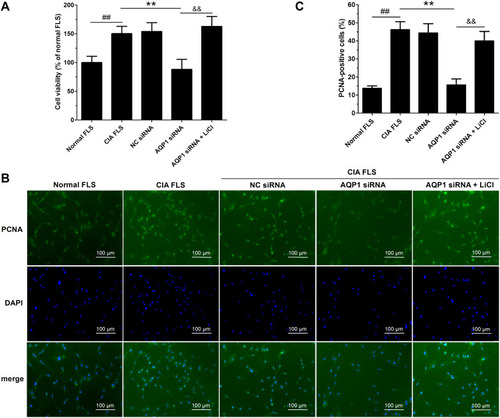 Figure 5 Inhibition of CIA FLS proliferation by AQP1 siRNA was abolished by LiCl. (A) The cell viability of different FLS groups, detected by MTT assay. (B) Typical photos of PCNA immunofluorescence staining from different FLS groups (×100). (C) Quantitative statistical results of PCNA-positive cells (%). The data are mean ± SEM of three to five independent experiments performed in triplicate. ##P < 0.01 compared with normal FLS group. **P < 0.01 compared with CIA FLS group. &&P < 0.01 compared with AQP1 siRNA group.