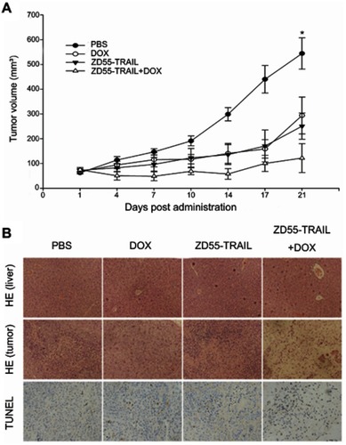 Figure 4 Antitumor effect of DOX and ZD55-TRAIL in Hep2 xenografts. Mice were treated with an intratumoral injection of PBS, DOX, ZD55-TRAIL, or ZD55-TRAIL followed by DOX. (A) Tumor volume was measured. *p<0.05. (B) Subcutaneous Hep2 tumors and liver tissues were performed for HE staining analysis (the upper two rows, original magnifcation: 100×). The lower row showed the cell apoptosis in tumor tissues by TUNEL assay (original magniﬁcation: 200×).