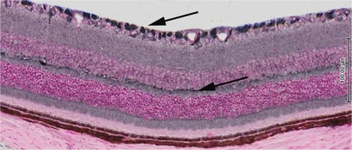 Figure 3 Cross-section of mouse retina post-natal day 21 demonstrating expression of the LGR4 receptor throughout the retina.