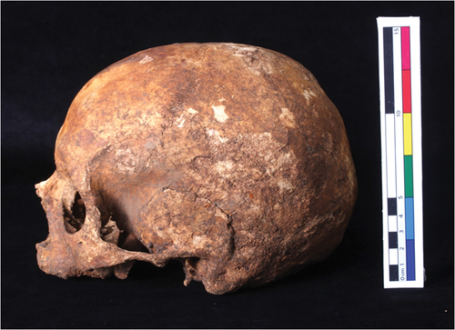 Figure 1. A left lateral view of the cranium to be examined by participants.