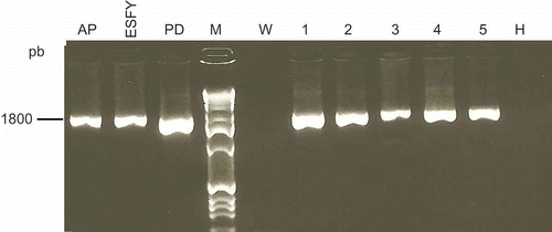 Fig. 1. PCR detection of phytoplasmas using the universal primer pair (P1/P7). Templates consisted of DNA extracted from periwinkle plants infected with the following phytoplasma reference strains: apple proliferation (AP); European stone fruit yellows (ESFY) and pear decline (PD) or from symptomless plum (H) and symptomatic plums (1–5). W, water control; M, marker.