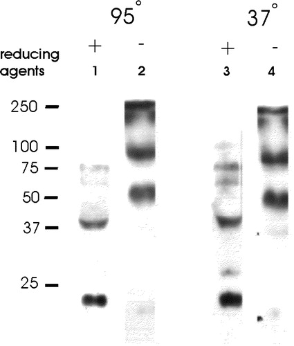 Figure 5.  Oligomers of sAnk1 are present under non-reducing conditions. Fresh homogenates of rat hindlimb muscle were mixed with 0.7 M 2-mercaptoethanol in SDS-PAGE sample buffer supplemented with 4 mM TCEP, or SDS-PAGE sample buffer lacking all reducing agents. Each sample was then either boiled for 5 min, or incubated for 15 min in sample buffer at 37°C. After electrophoresis, samples were transferred to nitrocellulose paper and immunoblotted with anti-p6 antibodies. All reduced samples showed a major band at ∼21 kDa, with smaller amounts of label apparent at ∼38, 58, 75 and 100 kDa. All unreduced samples failed to show significant amounts of label at 21 kDa and instead showed major bands at ∼46 and ∼80 kDa, consistent with the presence of dimers and tetramers of sAnk1.