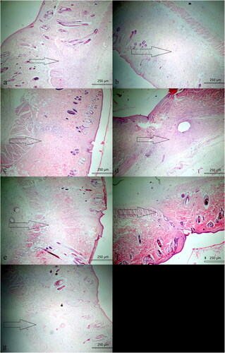 Figure 2. Minimal fibrosis is observed in wound healing in EE-14 group (HE; ×40).