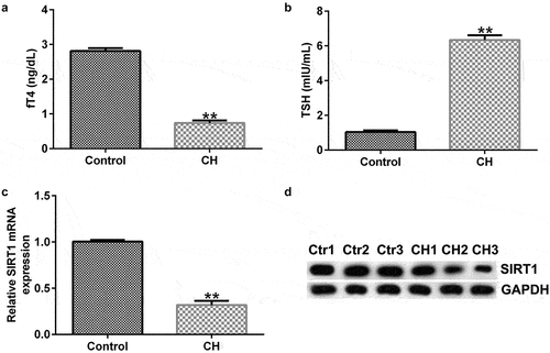 Figure 1. Expression levels of sirtuin 1 (SIRT1) in congenital hypothyroidism (CH) model rats. CH rat models were established with propylthiouracil. (a) fT4 level in the plasma of rats. (b) TSH level in the plasma of rats. (c) Reverse transcription-quantitative polymerase chain reaction (RT-qPCR) was performed to determine the mRNA expression levels of SIRT1 in the hippocampal tissues of CH and normal rats. **P < 0.01. (d) Protein expression levels of SIRT1 in rat hippocampal tissues were detected using by blotting analysis. SIRT1, sirtuin 1; CH, congenital hypothyroidism.