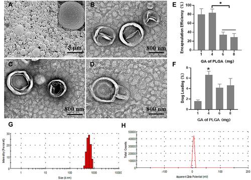 Figure 5 Characterizations of GA/PLGA-CMBs. (A) GA/PLGA was spherical and uniformly dispersed under scanning electron microscope (SEM). (B) GA/PLGA was spherical and wrinkled under transmission electron microscope (TEM). (C) CMBs showed spherical and hollow structure under TEM. (D) GA/PLGA-CMBs is composed of CMBs and GA/PLGA under transmission electron microscope. (E and F) Every 50 mg PLGA, 4 mg GA is added to prepare GA/PLGA. The entrapment efficiency of GA/PLGA was 83.04% ± 7.51% (*p<0.05 versus each other group). The drug loading of GA/PLGA was 6.64 ± 0.60% (*P <0.05 versus other three groups). (G and H) The particle size distribution of GA/PLGA-CMBs is 951.37 ± 110.32 nm.The potential distribution of GA/PLGA-CMBs was 5.30 ± 0.49 mV.