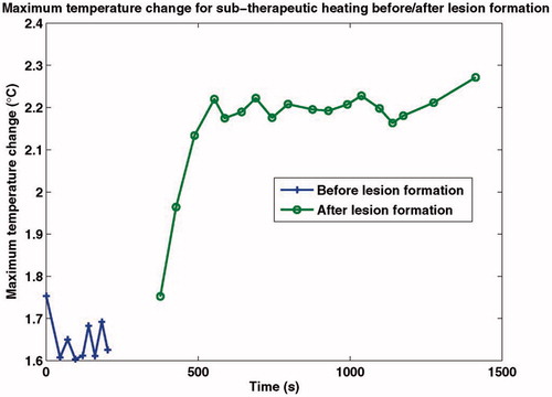 Figure 4. Maximum temperature change due to the application of 1.7-s sub-therapeutic HIFU ‘shots’ before and after the application of a 5-s therapeutic HIFU ‘shot’. Reproduced from Liu and Ebbini [Citation85] with permission.