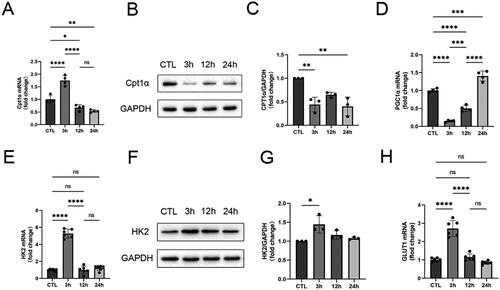 Figure 4. Metabolic reprogramming of fatty acid oxidation to glycolytic transformation in HK-2 cells in H/R. A-C qRT-PCR and western blots analysis of Cpt1α. D qRT-PCR analysis of PGC1α. E-G qRT-PCR and western blots analysis of HK2. H qRT-PCR analysis of GLUT1.GAPDH was used as the internal control. Data are expressed as mean ± SD and p < 0.05 was considered statistically significant (*p < 0.05, **p < 0.01, ***p < 0.001, ****p < 0.0001, nsP > 0.05).