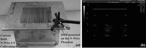Figure 6. (a) The N-wire US probe calibration phantom. (b) A US image showing the cross-section of the N-wires.