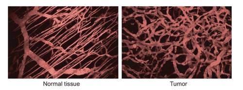 Figure 1 Organized vasculature in normal tissue contrasted with chaotic vasculature in tumors.