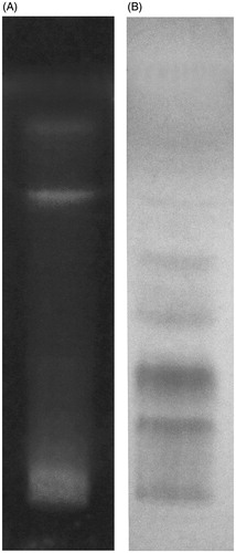 Figure 1. Chromatogram showing bands of (A) flavonoids derivatized with NP reagent and (B) tannins derivatized with vanillin sulphuric acid reagent.