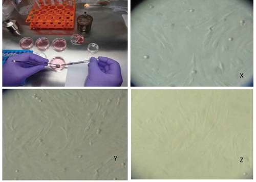 Figure 2. Aspiration and culture of the granulosa cells from antral follicle of sheep. Antral follicles (~3.5mm) were punctured by 26G needle (Becton Dickenson) and the follicular fluid was aspirated for culturing of the sheep granulosa cells. The morphological features of the granulosa cells of non-carrier Malpura (FecB++) (X), homozygous carrier GMM (FecBBB) (Y), and non-carrier GMM (FecB++) (Z) shown in the culture of McCoy’s 5A medium. All granulosa cells were healthy and appeared like an epithelial cells.