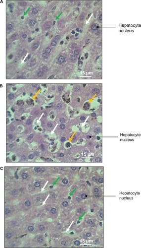 Figure 2 H and E stained sections showing liver architecture and sinusoids of (A) infected mouse given cocoa, (B) infected mouse not given cocoa, and (C) control mouse. White arrows indicate hepatic sinusoids. Kuppfer cells (orange arrows) in (B) have undergone hypertrophy compared with those in (A) and (C) green arrows.