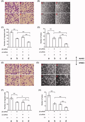 Figure 2. T7 suppresses migration and tube formation of endothelial cells by binding with integrin α3β1 and αvβ3. (A, B) HUVECs were treated with or without T7, α3 siRNA, or β3 siRNA and subjected to cell migration assay. The migrated cells were photographed and quantified (×400 magnification). Data represent three independent experiments. **A highly significant (p<.01) difference. (C, D) HUVECs were treated with or without T7, α3 siRNA, or β3 siRNA and subjected to tube formation assay. The tubes were photographed and quantified (×100 magnification). Data represent three independent experiments. (E, F) HPMECs were treated with or without T7, α3 siRNA, or β3 siRNA and subjected to cell migration assay. The migrated cells were photographed and quantified (×400 magnification). Data represent three independent experiments. (G, H) HPMECs were treated with or without T7, α3 siRNA, or β3 siRNA and subjected to tube formation assay. The tubes were photographed and quantified (×100 magnification). Data represent three independent experiments. *A significant (p<.05) difference; **A highly significant (p<.01) difference.