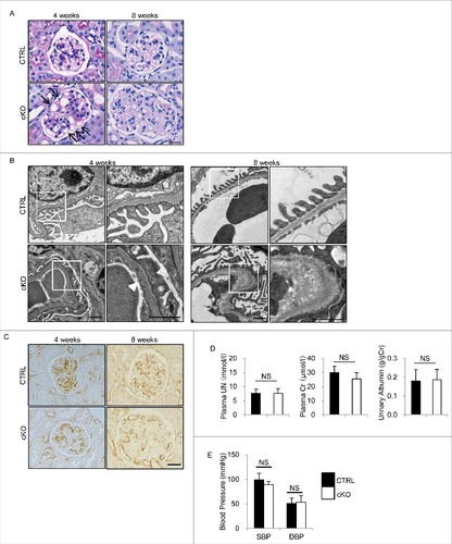 Figure 3. Glomerular abnormalities of atg5-cKO mice. Representative images of PAS staining (A), electron micrographs (B), and immunohistochemical analysis for PECAM1 (C) of glomeruli from 4- and 8-wk-old atg5-cKO and Atg5-CTRL mice (n = 4 to 6 in each group). (A) Distended capillary loops (arrows). (B) Segmental loss of glomerular endothelial fenestra (arrowhead) accompanied by foot process effacement of podocytes (arrow) adjacent to the transformed ECs. The right panels show a magnification of the indicated areas (white squares) in the left panels. Bars: 20 μm (A and C) and 1 μm (B). Plasma UN and creatinine, urinary albumin/creatinine ratio (D), and blood pressure (E) of 4- (D) and 6- (E) wk-old atg5-cKO and Atg5-CTRL mice are shown. n = 6 for plasma UN and creatinine; n = 9 to 14 for urinary albumin/creatinine ratio; and n = 3 or 4 (E) in each group. Data are provided as the mean ± SD. NS, not significant. SBP, systolic blood pressure; DBP, diastolic blood pressure.