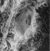 Figure 1 Microvessel lined by endothelium in the outer media wall, ×1,350.