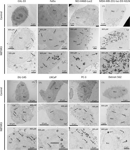 Figure 1 NBTXR3 nanoparticles are endocytosed by cancer cells and form clusters in the cytoplasm. Transmission electronic microscopy (TEM) representative images of NBTXR3 nanoparticles uptake, forming clusters in CAL-33, FaDu, NCI-H460-Luc2, MDA-MB-231-luc-D3-H2LN (upper panel) and DU-145, LNCaP, PC-3, Detroit 562 cells (lower panel). Cells were treated overnight with NBTXR3. 100µM, 400µM and 800µM indicate concentrations of NBTXR3 added to cells; arrows indicate NBTXR3 clusters.