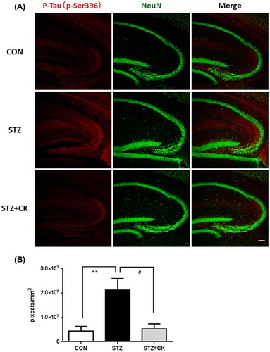 Figure 4. Effects of the dried peel powder of C. kawachiensis on the expression of phosphorylated Tau at 396 of serine in the hippocampus in experiment 1. (A) Sagittal sections were stained with the anti-pSer396 (red) and NeuN (green) antibodies. The scale bar shows 100 μm. (B) Quantitative analysis of pSer396-positive signals using ImageJ software. Values are means ± SEM. Symbols show significant differences between the following conditions: CON vs STZ (**p < 0.01), and STZ vs STZ + CK (# p < 0.05).