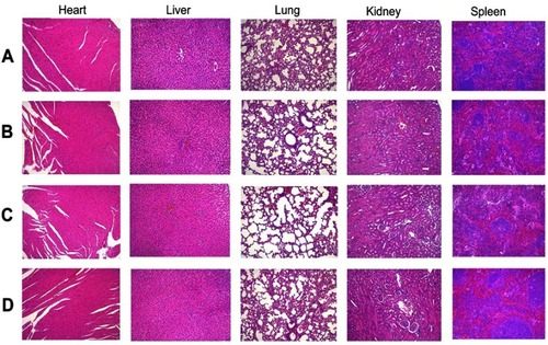 Figure 8 HE staining of major organ after treatment with (A) Normal Saline, (B) Blank-NLC (B-NLC), (C) c(RGDfK)-B-NLC, (D) E-[c(RGDfK)2]-GA-NLC (magnification 100×).