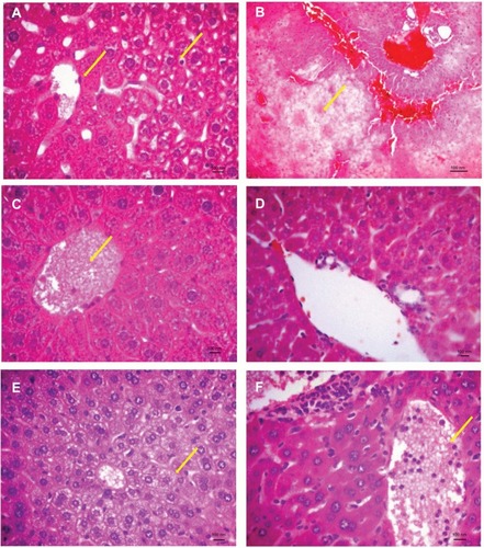 Figure 4 Histological features of mice liver treated with compounds I, II or diclofenac for 7 and 30 days.Notes: (A) Liver of compound I treated mice showing vacuolization, edema and some hepatocytes necrosis after 7 days (arrows); (B) liver of compound II treated mice showing severe ballooning and congestion after 7 days (arrow); (C) liver of diclofenac sodium (arrow indicates congestion); (D) liver of control mice showing normal architecture; (E) liver of compound I treated mice showing vacuolization after 30 days (arrow); (F) liver of diclofenac treated mice showing congestion after 30 days (arrow). Photos were taken at 40× magnification.