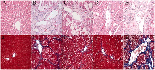 Figure 1. Antifibrotic properties of hydroxysafflor yellow A (HSYA) on histological assessment of liver fibrosis in CCl4 with HFD-treated rats. Rats were treated according to the procedures described in the Methods section. Paraffin sections of livers from treated rats were stained with hematoxylin and eosin (H&E) or Masson’s trichrome. Panels (A)–(E) show representative images of liver sections stained with H&E from the normal group, model group, HSYA+GW9662 group, HSYA group, and GW9662 group, respectively. Panels (a)–(e) are images of sections stained with Masson’s trichrome from the normal group, model group, HSYA+GW9662 group, HSYA group, and GW9662 group, respectively. Images were taken and analyzed using Image-Pro plus system (Media Cybernetics, Inc, Rockville, MD) (original magnification 200×).