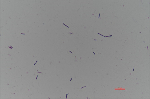 Figure 2 Gram staining of the bacterial isolate.