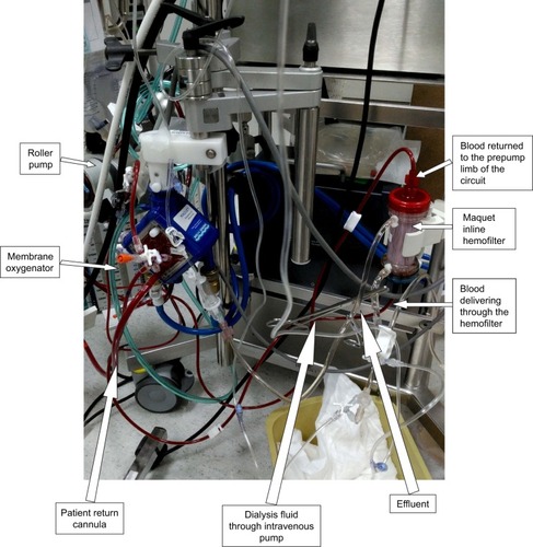 Figure 2 ECMO circuit with an inline hemofilter system.
