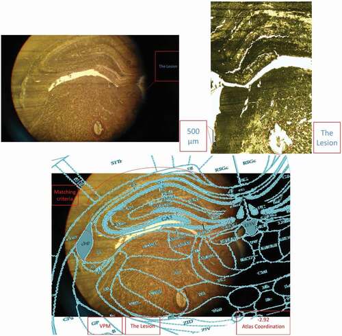 Figure 3. A histology image example (placement confirmation of the left side electrodes).