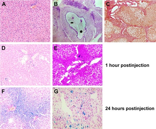 Figure 8 Histological analysis of the liver microsection.Notes: Hematoxylin and eosin staining of (A) healthy (×100) and (B) O. felineus-infected hamster liver (×50). (C) Van Gieson staining of O. felineus-infected hamster liver (×100). Prussian blue staining of (D, F) healthy (×200) and (E, G) O. felineus-infected hamster liver (×200) harvested 1 and 24 hours after the administration of MNPs-NH2 at a dose of 0.6 mg kg−1.Abbreviations: O. felineus, Opisthorchis felineus; MNPs, magnetic nanoparticles.