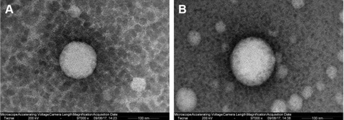 Figure 2 Transmission electron microscope photograph of PTX and CUR co-loaded LPs.Note: (A) Not RGD modified, (B) RGD modified (magnification ×97,000).Abbreviations: PTX, paclitaxel; CUR, curcumin; LPs, liposomes; RGD, arginine, glycine, aspartic acid peptide.