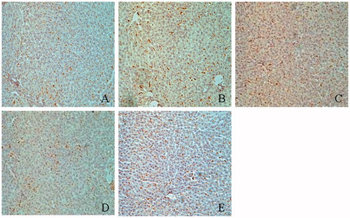 Figure 6. Immunostaining of ED-1 positive cell in the liver. (A) Normal; (B) control diabetic; (C) diabetic + TGP 50 mg/kg; (D) diabetic + TGP 100 mg/kg; (E) diabetic + TGP 200 mg/kg. Original magnification 100×.